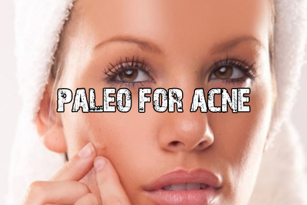 Fight and Get Rid of Acne Using the Paleo Diet - Pro paleo Diet